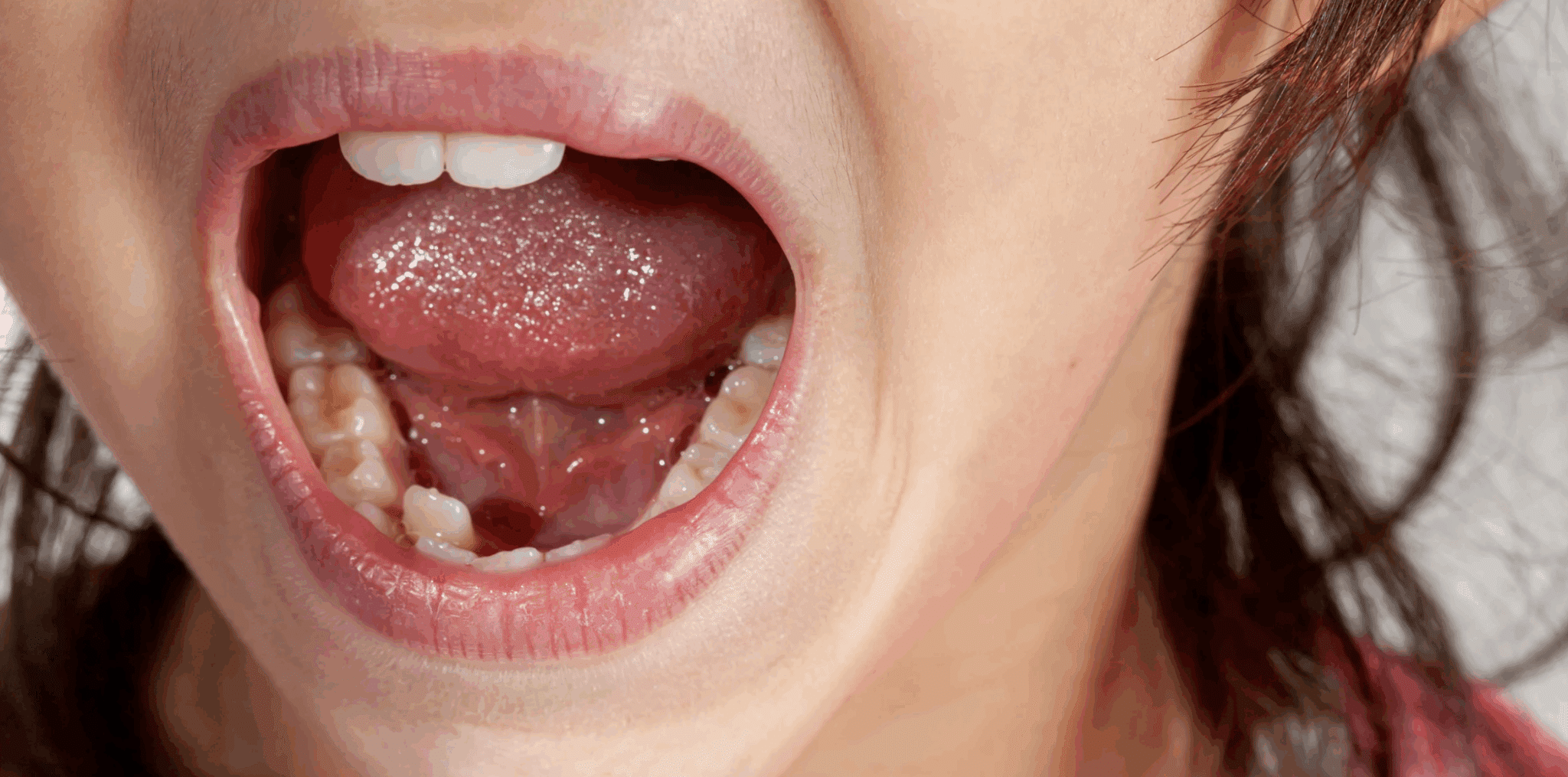 Comment savoir si c’est une dent de lait ou une dent définitive ?