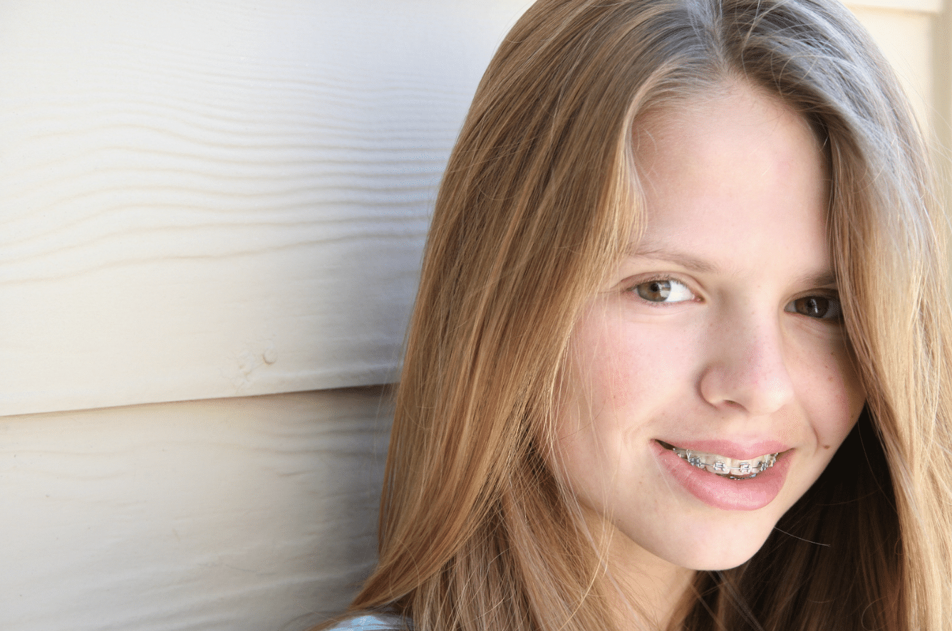 Quels sont les différents types d’appareils orthodontiques pour enfants ?