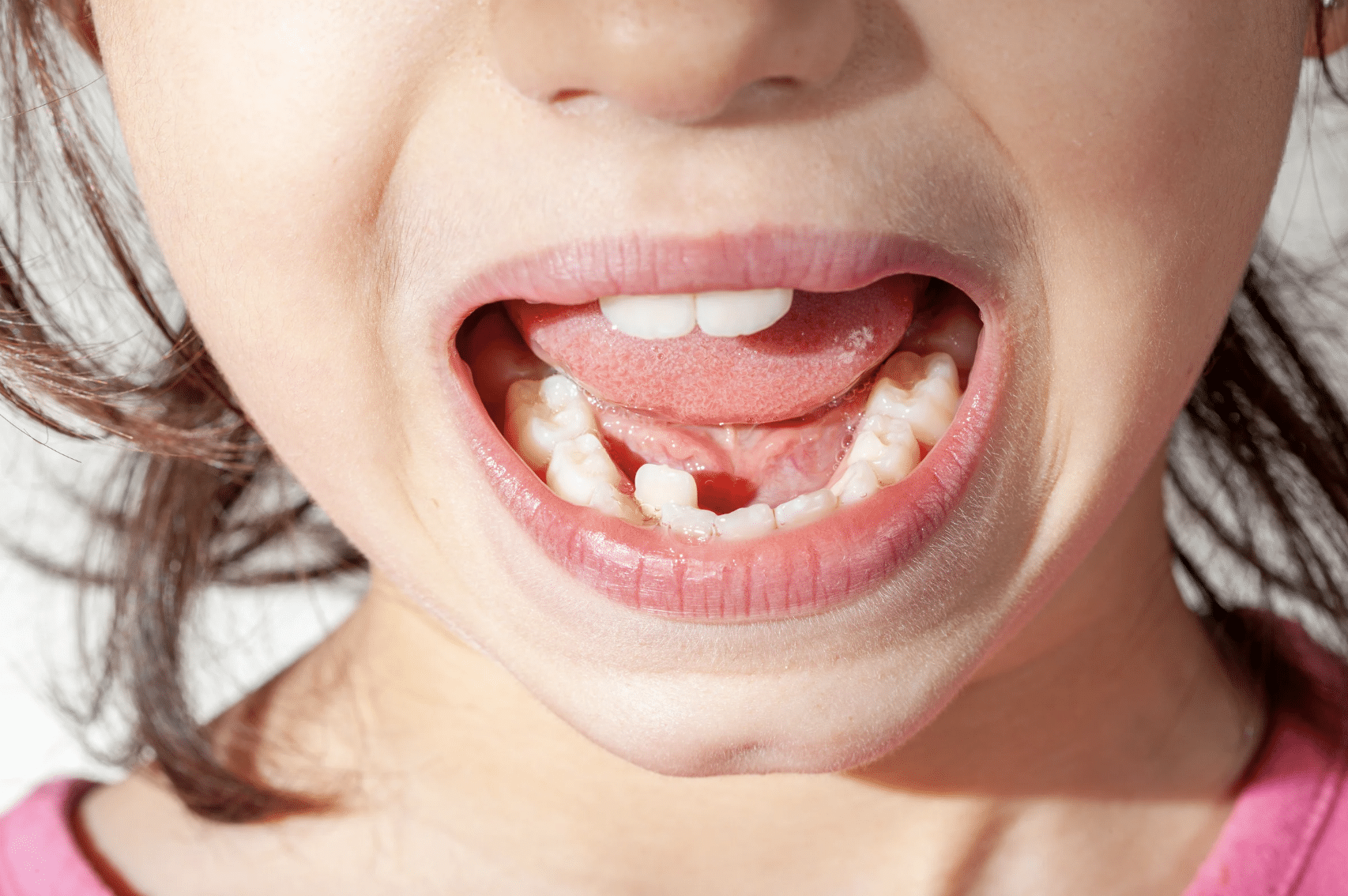Mon enfant se plaint des gencives : quelles causes possibles ?